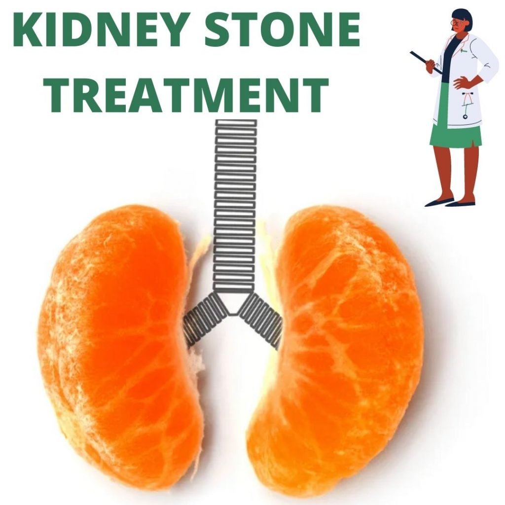 kidney stone treatment