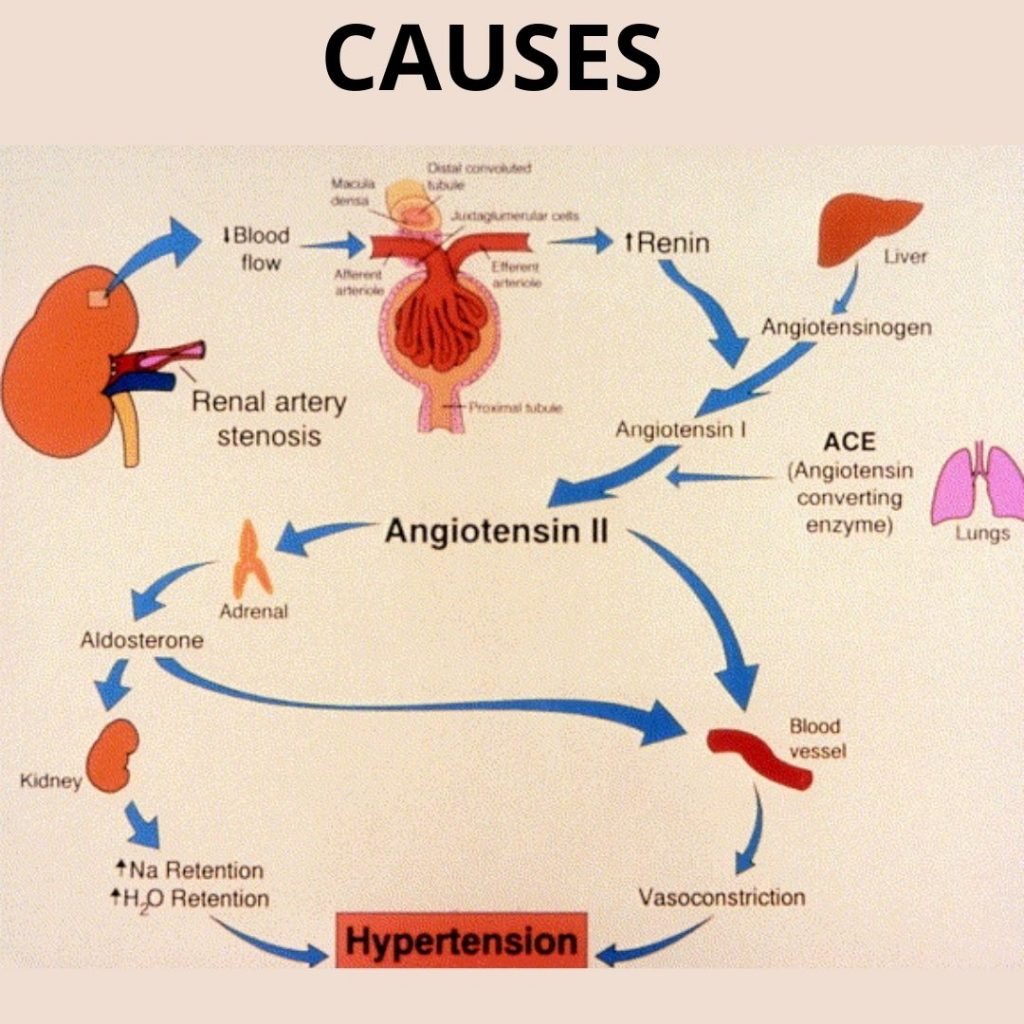 renal hypertension treatment