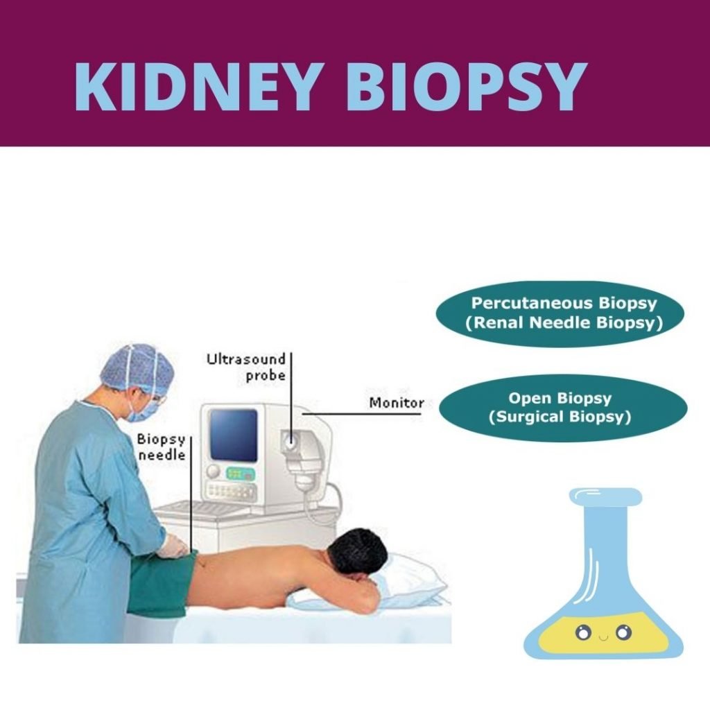 KIDNEY DISEASE