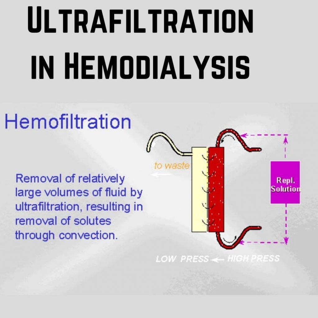 hemodialysis ultrafiltation