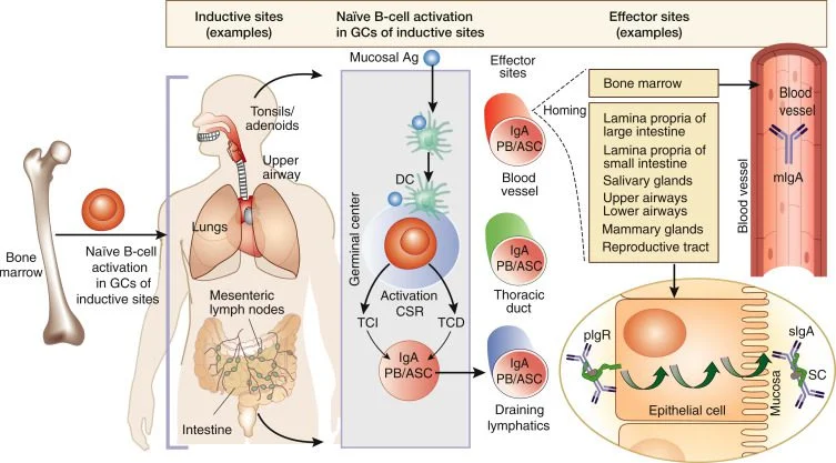 IgA Nephropathy
